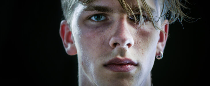 Close-up Portrait Shot of a Drug Addict Suffering Young Boy Sadly Looking into the Camera. He Looks Thin, Badly Beaten and His Face is Bruised. Background is Isolated Black.